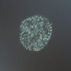 Uroglena volvox, <a href="https://en.wikipedia.org/wiki/Chrysophyta" target="_blank">Chrysophyta </a>
