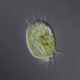 Euplotes patella, <a href="https://en.wikipedia.org/wiki/Ciliate" target="_blank">Ciliate </a>
