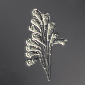 Epistylus procumbens, <a href="https://en.wikipedia.org/wiki/Ciliate" target="_blank">Ciliate </a>